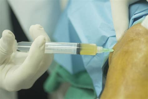 Does kaiser do prp injections. Things To Know About Does kaiser do prp injections. 